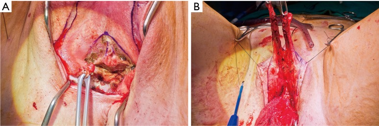 Figure 14