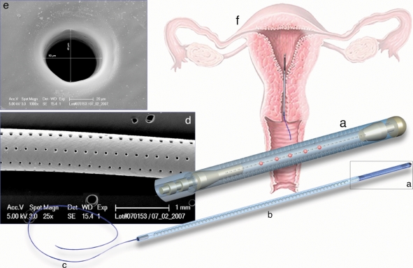 Figure 1