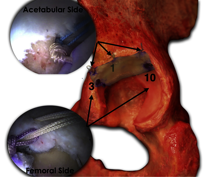 Fig 6