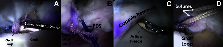 Fig 5