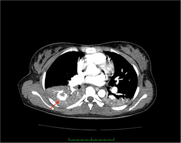 Fig. 1