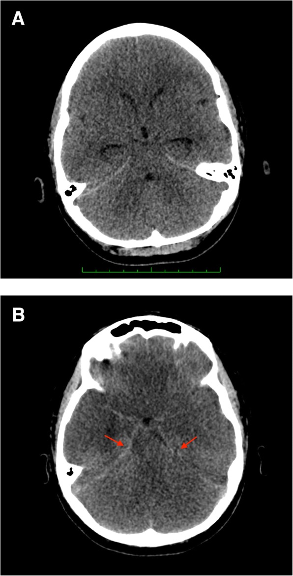 Fig. 2