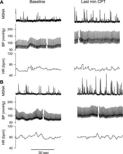 Heat Stress Attenuates The Increase In Arterial Blood Pressure During 