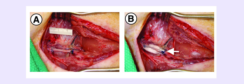 Figure 3. 