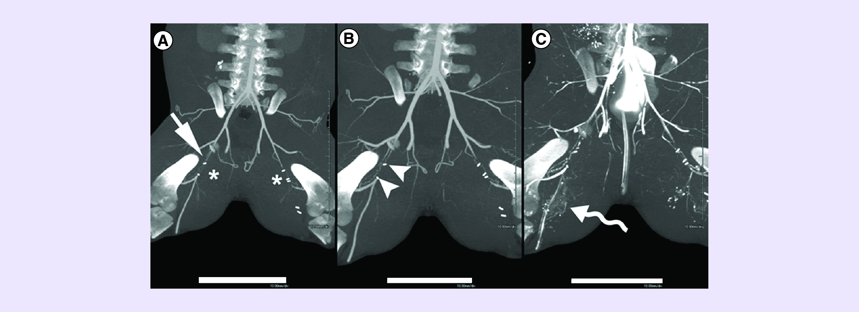 Figure 4. 