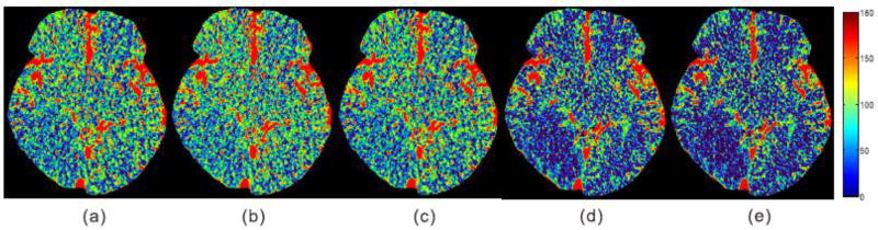 Fig. 12