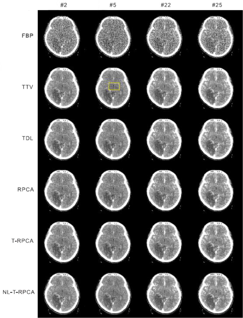 Fig. 11