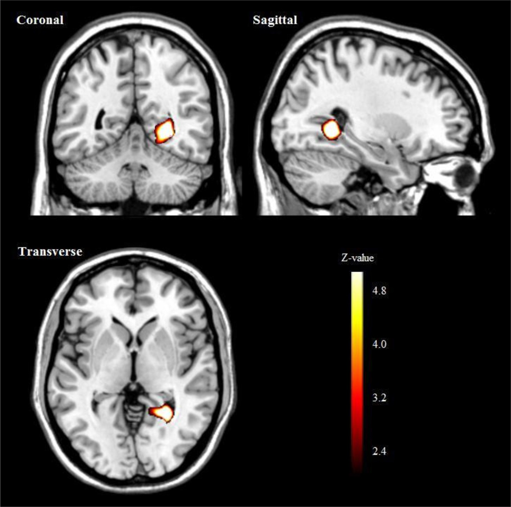 Increased brain activity to unpleasant stimuli in individuals with the ...