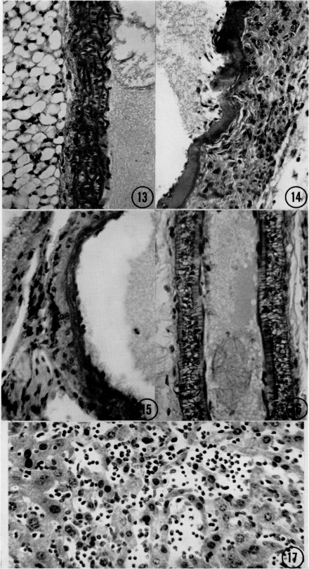 Figs. 13-17