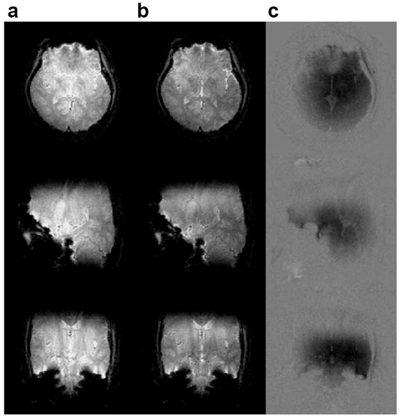 FIG. 9