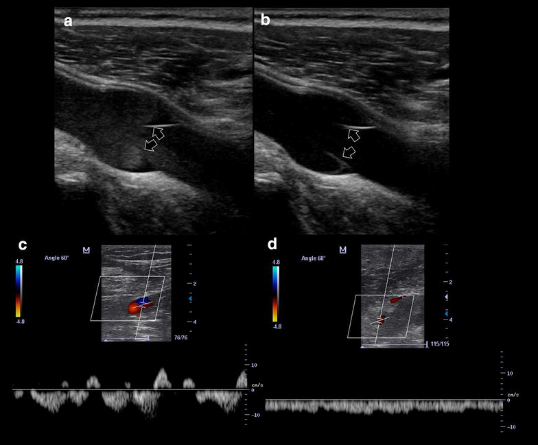 Fig. 6