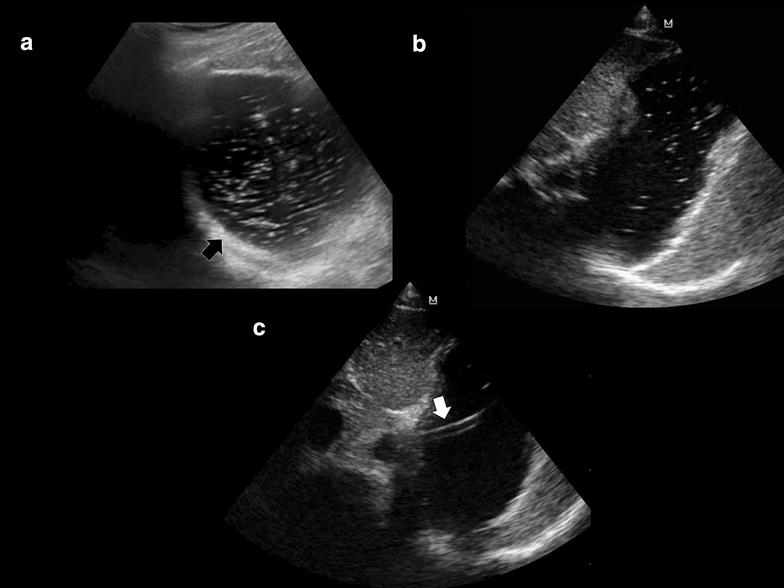 Fig. 4