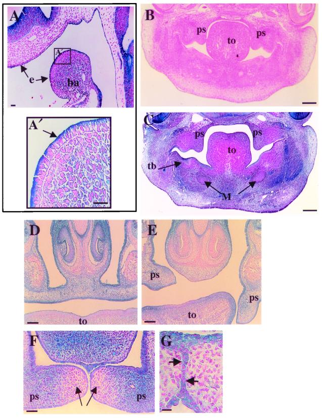 FIG. 5