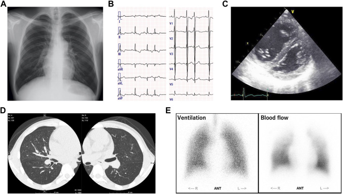 FIGURE 1