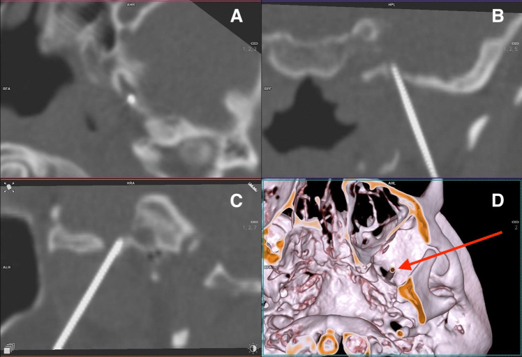 Fig. 2