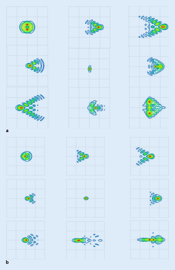 graphic file with name 347_2020_1235_Fig4_HTML.jpg