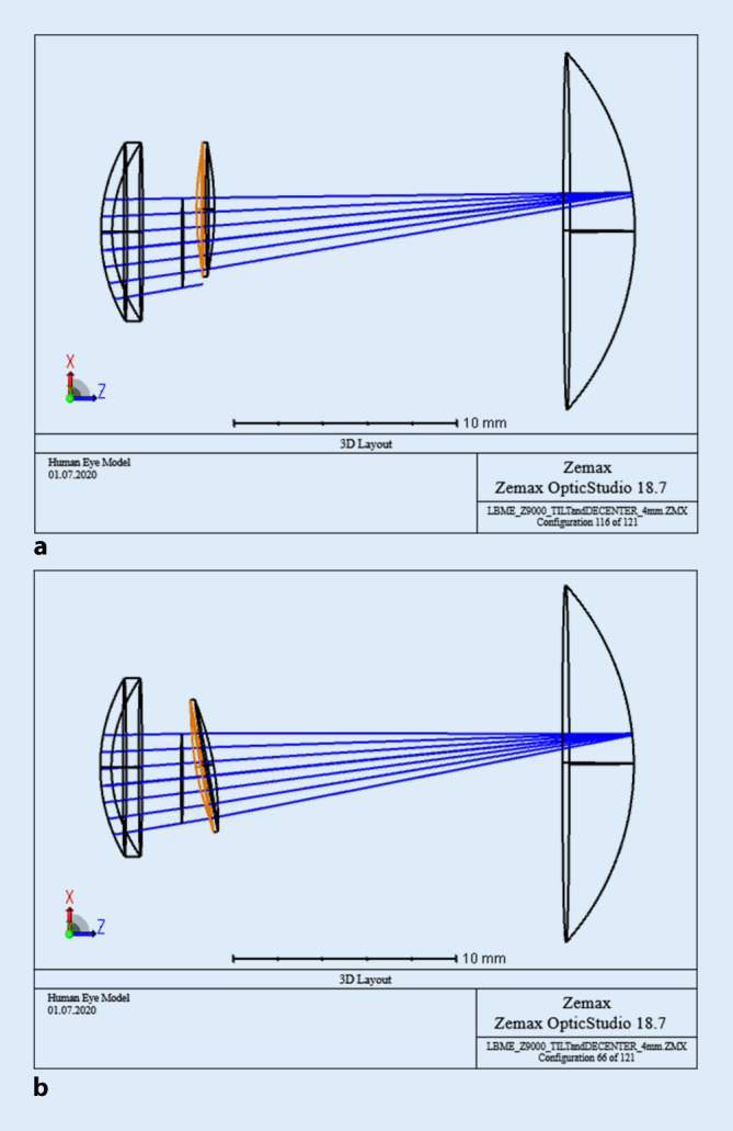 graphic file with name 347_2020_1235_Fig1_HTML.jpg