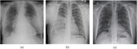 Fig. 10