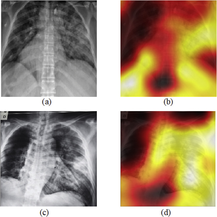 Fig. 11