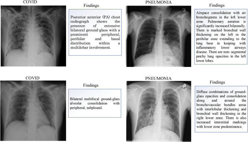 Fig. 12