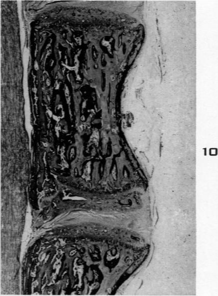 Fig. 10