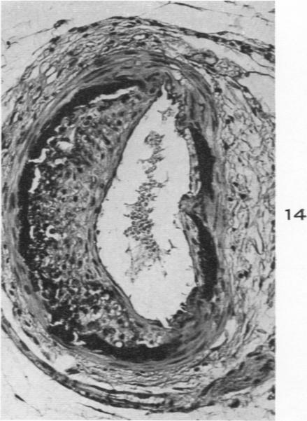 Fig. 14