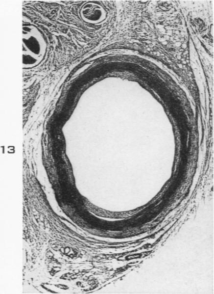 Fig. 13