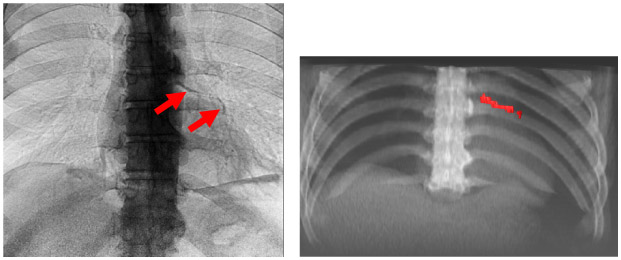 Fig 2.