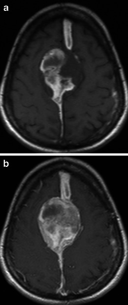 Fig. 18