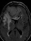 Fig. 16