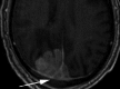 Fig. 14