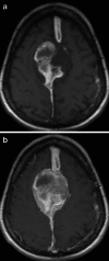 Fig. 18