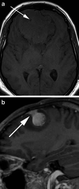 Fig. 19