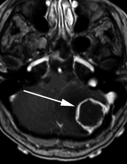 Fig. 17