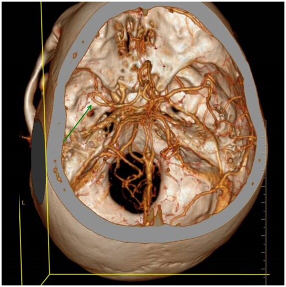 Figure 3