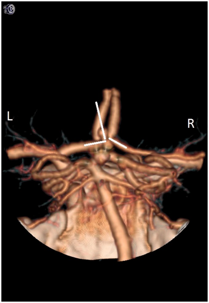 Figure 6.