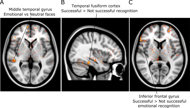 Figure 6—figure supplement 3.