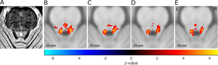 Figure 4—figure supplement 1.