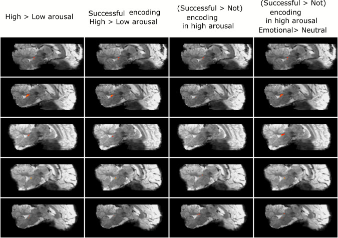 Figure 6—figure supplement 2.