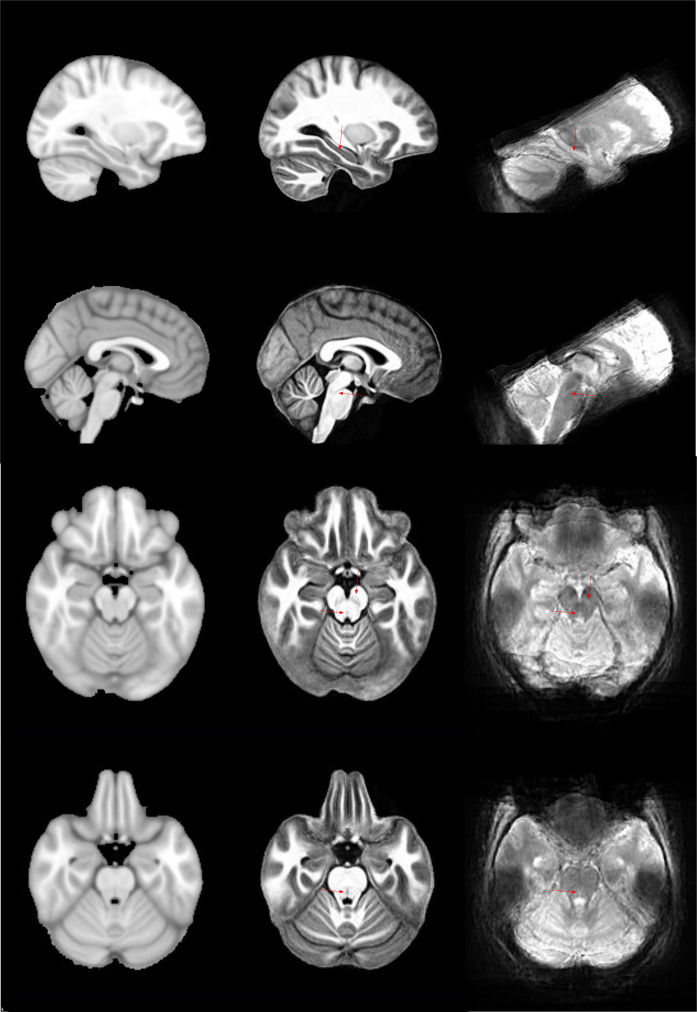 Figure 1—figure supplement 1.