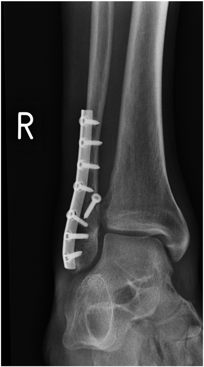 Fig. 2