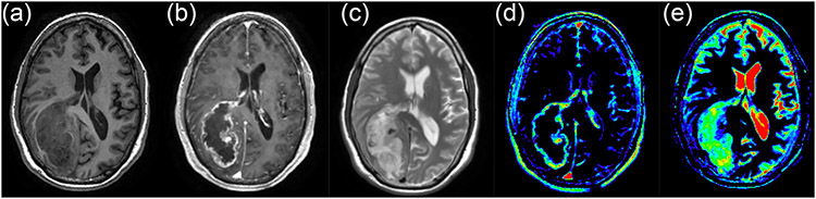 Figure 1: