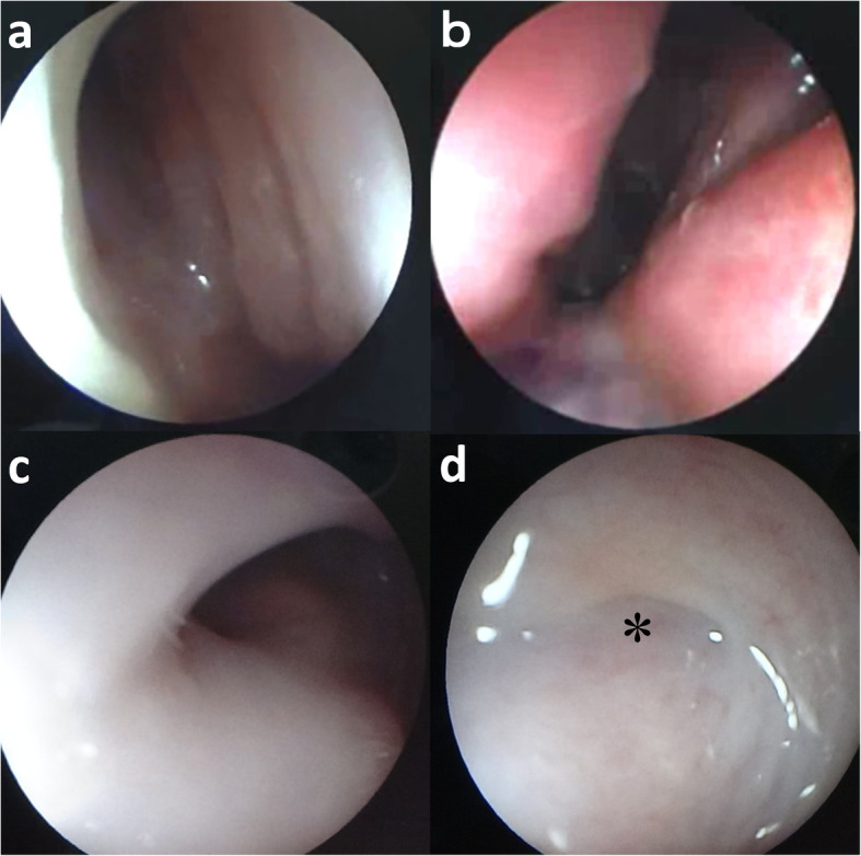 Fig. 4