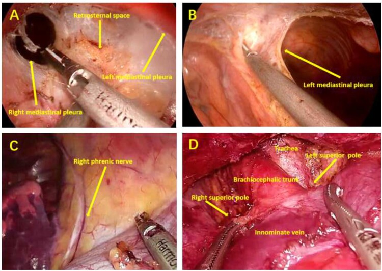 Figure 2: