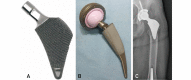 Fig. 13