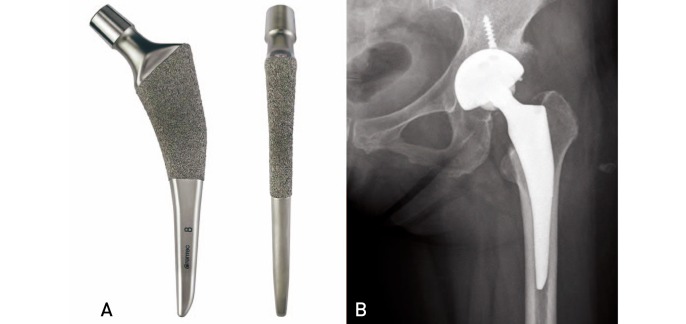 Fig. 15