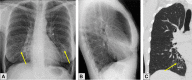 Figure 16