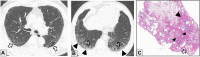 Figure 14