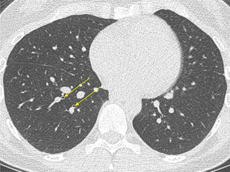 Figure 5