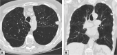 Figure 13